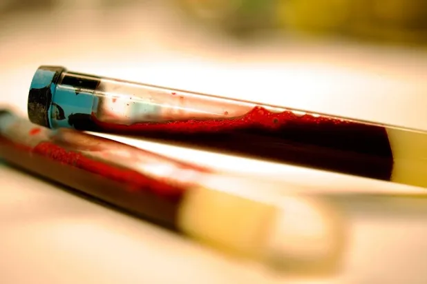 تحديد مؤشرات حيوية لمرض باركنسون يمكن رصدها في الدم (جامعة تشالمرز للتكنولوجيا)