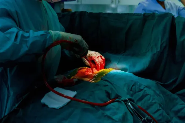 يؤدي العلاج الجديد أيضاً إلى تقليل الآثار الجانبية لجراحة زرع الكُلى (الشرق الأوسط)