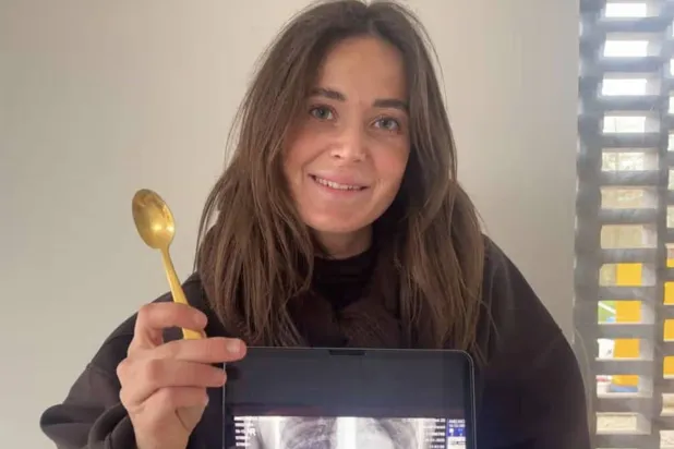 ريمي أميلينكس تحتفظ بالملعقة التي ابتلعتها (فيسبوك)