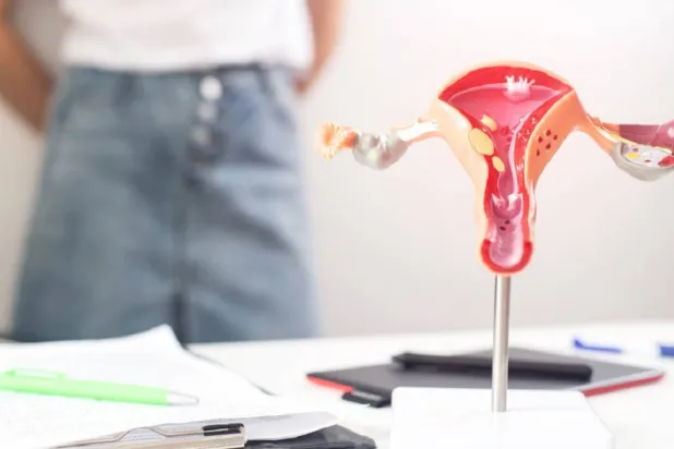 الاستئصال الوقائي لقناتي فالوب يقلل خطر الإصابة بسرطان المبيض (جامعة كولومبيا البريطانية)