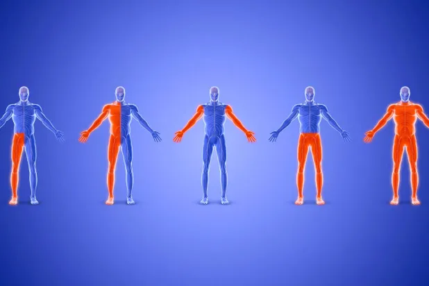 مرونة مفرطة في المفاصل وهشاشة الأنسجة… من أعراض متلازمة إهلرز - دانلوس مفرطة الحركة