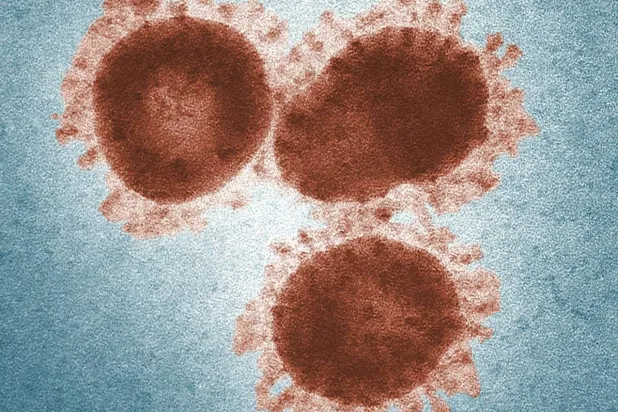 وفاة شخصين وإصابات خطيرة بالسحايا في بريطانيا... ماذا نعرف عن المرض؟