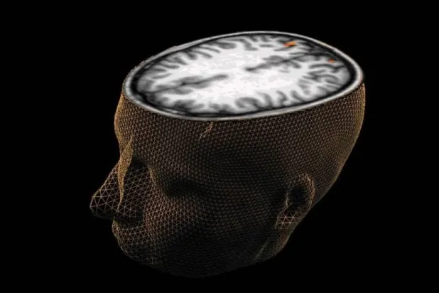 الأدوية المتوفرة حالياً لا تحسن المشكلات الإدراكية مثل التفكير غير المنظم (رويترز)