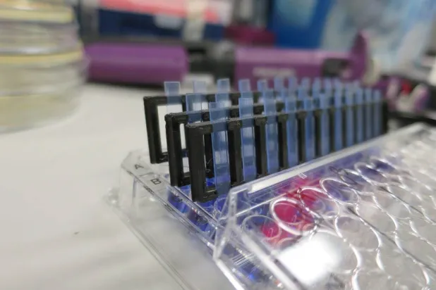 الاختبار الجديد يحدد العلاج الدقيق لالتهاب المسالك البولية خلال ساعات (جامعة ريدينغ)