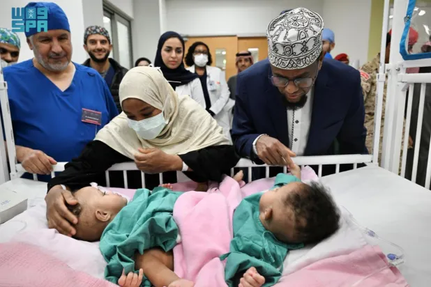 التوأم الملتصق الصومالي «رحمة ورملا» قبل العملية (واس)