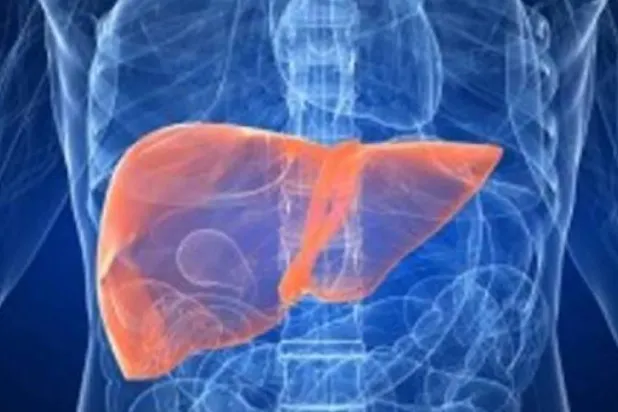 يُعدّ مرض الكبد الدهني المرتبط باضطرابات الأيض من أكثر الأمراض انتشاراً (رويترز)