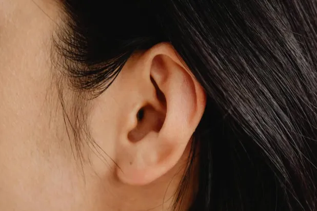 وجد الباحثون أن الورم الكوليسترولي ارتبط بزيادة خطر الإصابة بالخرف بمقدار 1.77 مرة (بكسلز)