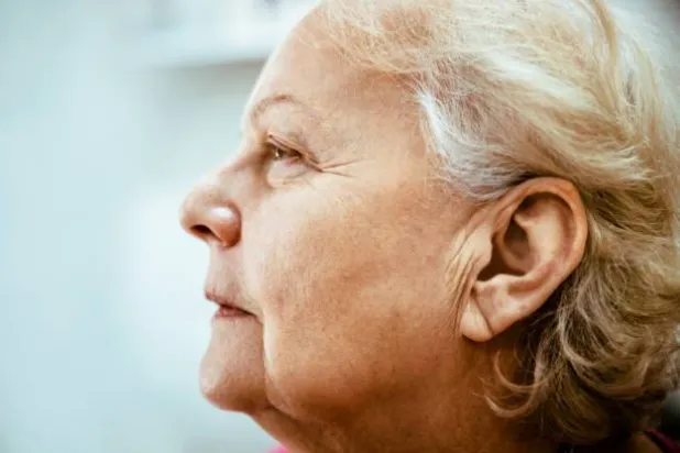 علامة فرانك هي تجعيدة مائلة في شحمة الأذن (بيكسلز)