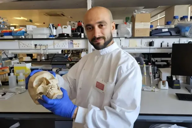 الدكتور شريف الشرقاوي الباحث الرئيسي للدراسة بجامعة كينجز كوليدج لندن يحمل مجسماً لجمجمة بشرية (جامعة كينجز كوليدج لندن)