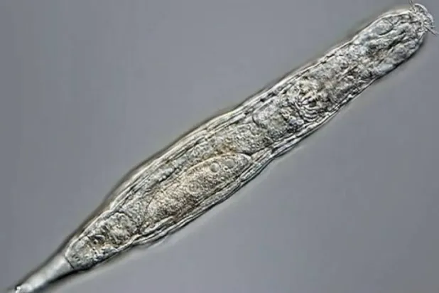 «دودة الزومبي» حيوان مجهري متعدد الخلايا (أرشيفية - أ.ف.ب)