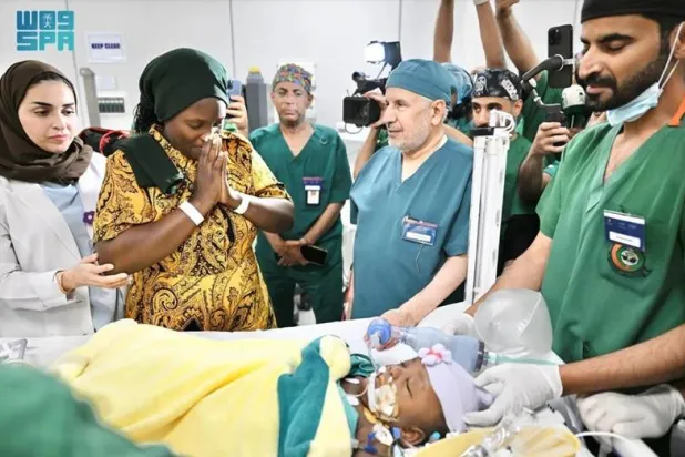 The twins were separated after a 16-and-a-half-hour procedure conducted across 10 stages. SPA