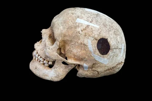 عُثر على جمجمة مثقوبة داخل حصن تل يعود إلى العصر الحديدي في واندلبوري (Cambridge Archaeological Unit)