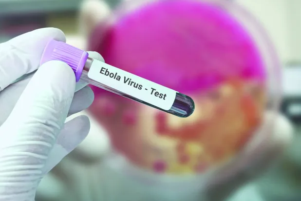 
أنبوبة لاختبار فيروس «إيبولا«