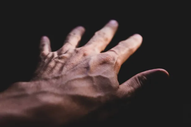 ترقق الجلد يُعد أحد أبرز الأسباب التي تؤدي إلى بروز الأوردة (بيكسلز)