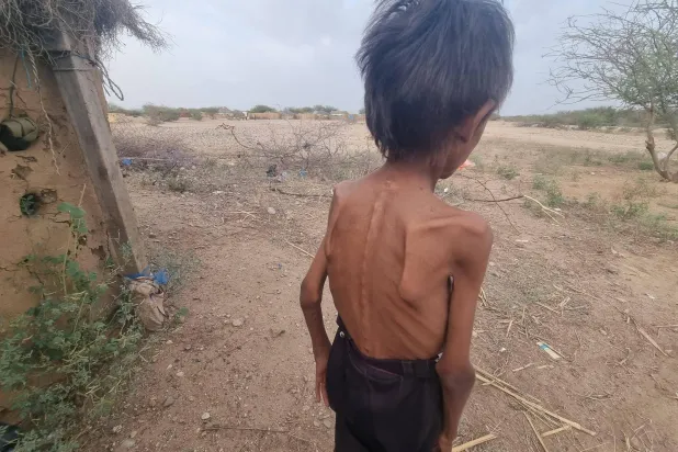 مع تسجيل جيوب للمجاعة يحتاج نصف سكان اليمن إلى المساعدات (إعلام محلي)