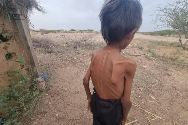 Yemen'de bazı bölgelerde kıtlık vakaları kaydedilirken, nüfusun yarısının yardıma ihtiyacı var, (Yerel medya)