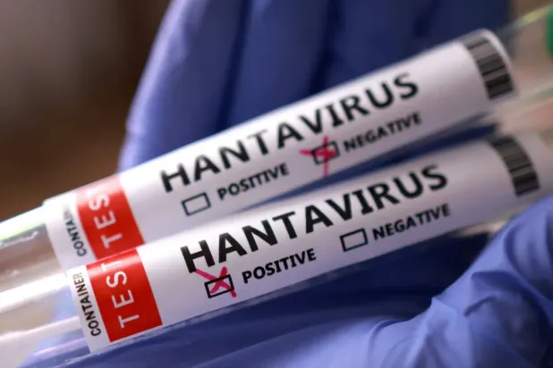 Hanta virüsü için kullanılan test tüpleri, (Reuters)