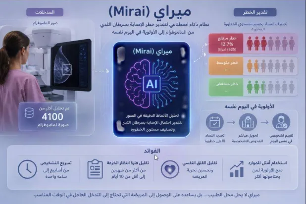 نظام «ميراي» للذكاء الاصطناعي
