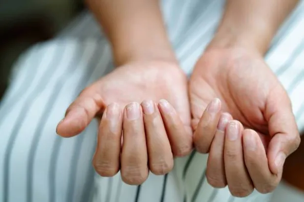 يعد البروتين من العناصر الأساسية لصحة الجلد والأظافر (بيكسلز)