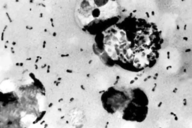 بكتيريا الطاعون «Yersinia pestis» (أ.ف.ب)
