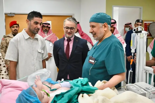 الدكتور عبد الله الربيعة يطمئن على التوأم الملتصق المغربي «سجى وضحى» قبل بدء العملية (واس)