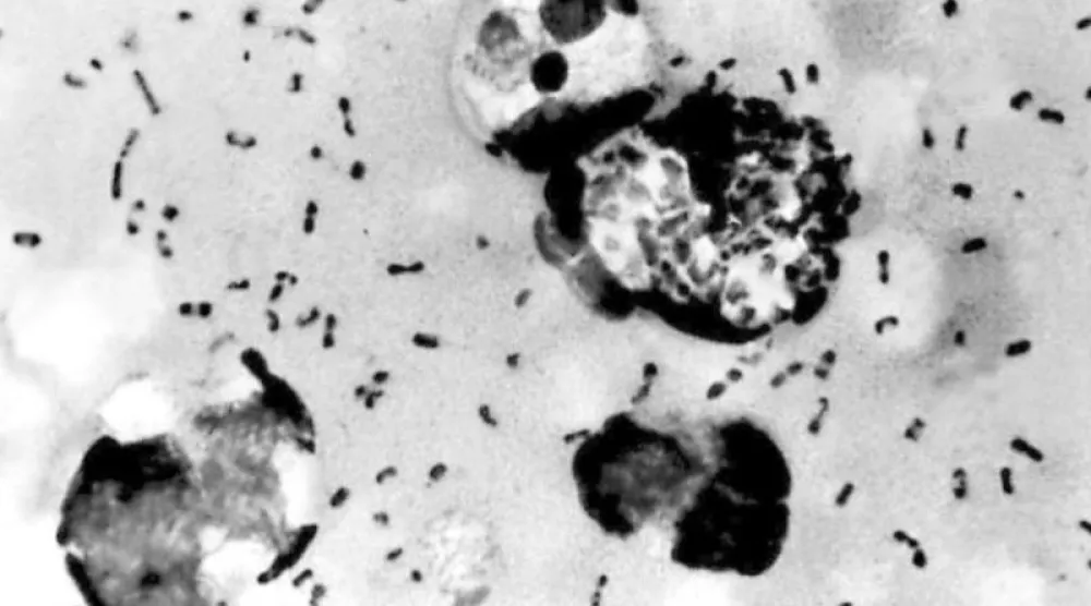 بكتيريا الطاعون «Yersinia pestis» (أ.ف.ب)
