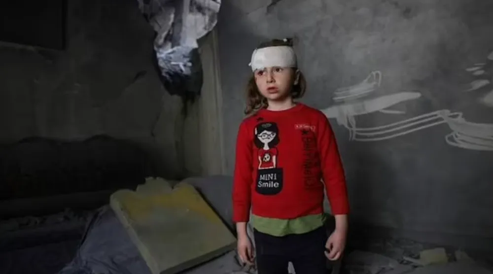 A wounded Palestinian girl stands amid the debris of her family home after overnight Israeli strikes - AFP