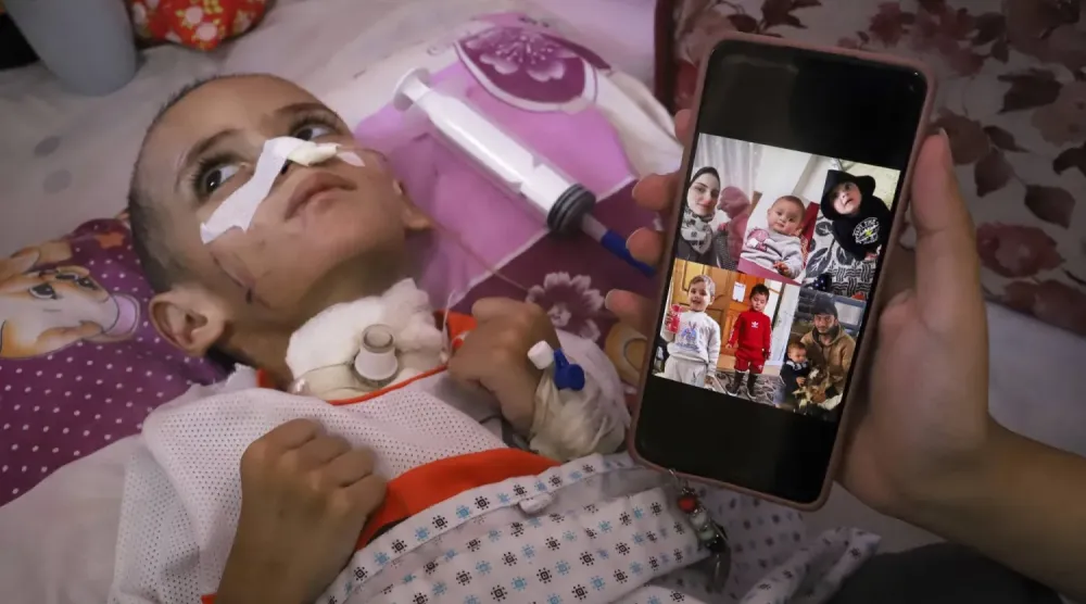  Gazze Şeridi'nin güneyindeki Han Yunus'ta bulunan Nasır Tıp Kompleksi'nde tedavi gören çocuk Ömer el-Hums (AP)