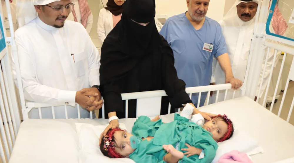 التوأم الملتصق السعودي «يارا ولارا» قبل بدء عملية الفصل (وزارة الحرس الوطني)
