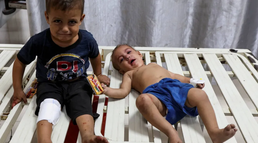أطفال فلسطينيون يتلقون العلاج بعد إصابتهم في غارة إسرائيلية بمستشفى ناصر في خان يونس جنوب القطاع (رويترز)