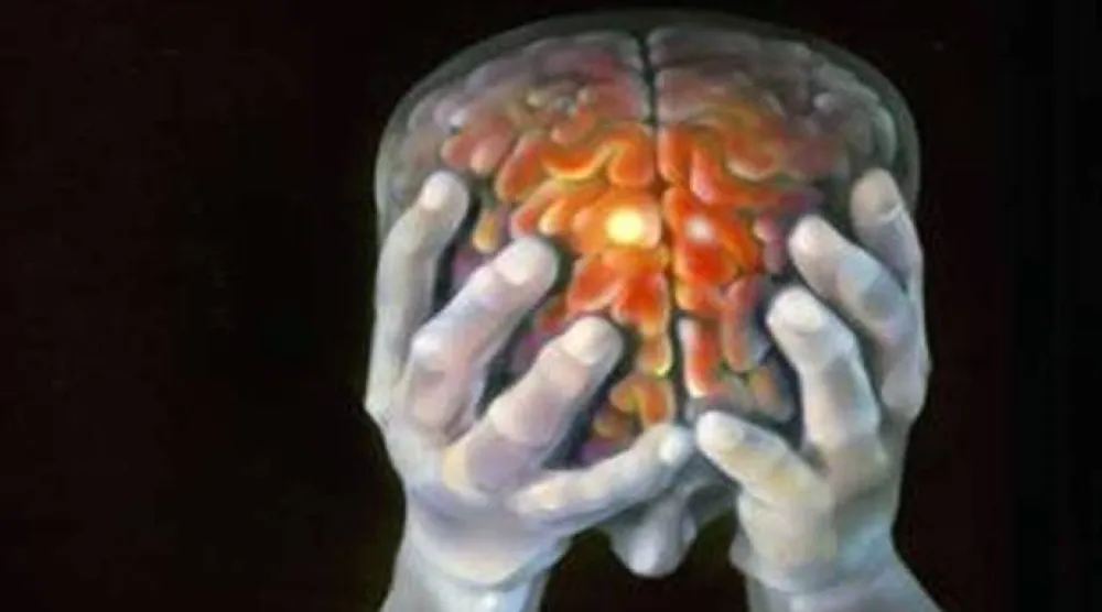 تُعدّ السكتة الدماغية أحد الأسباب الرئيسية للوفاة في العالم (رويترز)