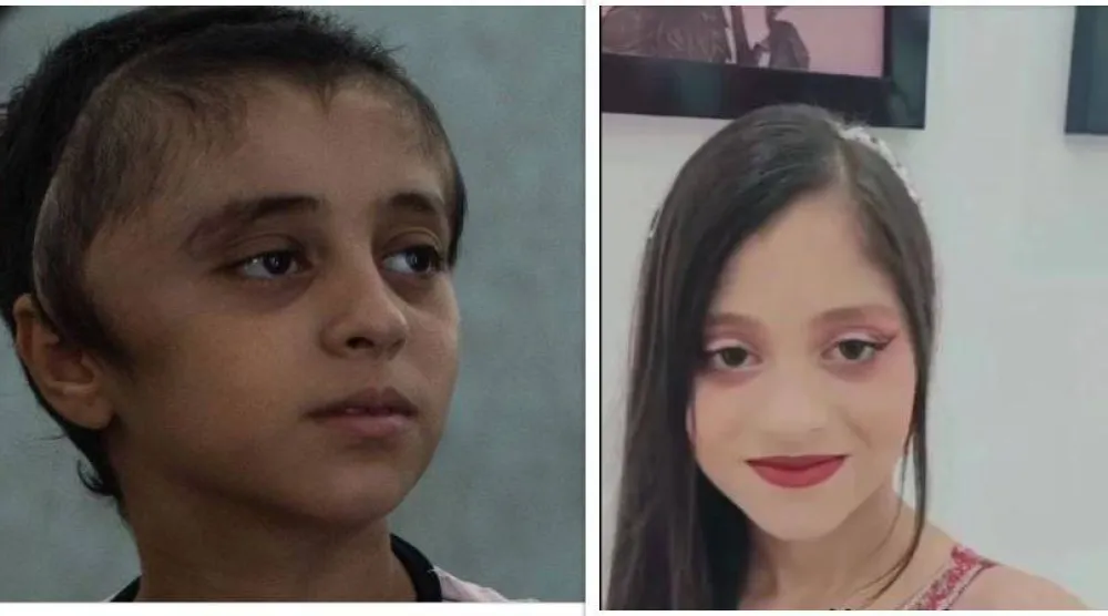 على اليمين صورة لمريم إبراهيم قبل الإصابة في الحرب... ويساراً صورة لها بعد الإصابة (وسائل إعلام محلية - إ.ب.أ)