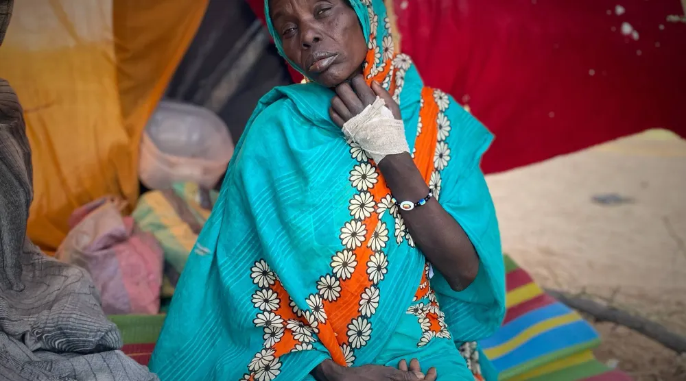سيدة سودانية أصيبت في معارك الفاشر بالسودان تجلس في خيمتها مخيم طويلة (أ.ب)