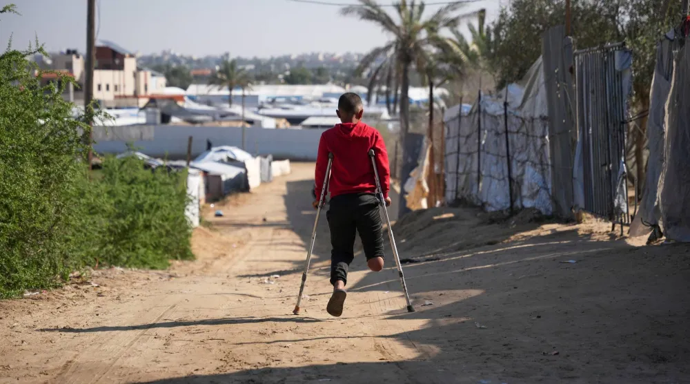 فتى بُترت ساقه في غزة من الذين يحتاجون إلى مساعدات «الأونروا» (أ.ب)