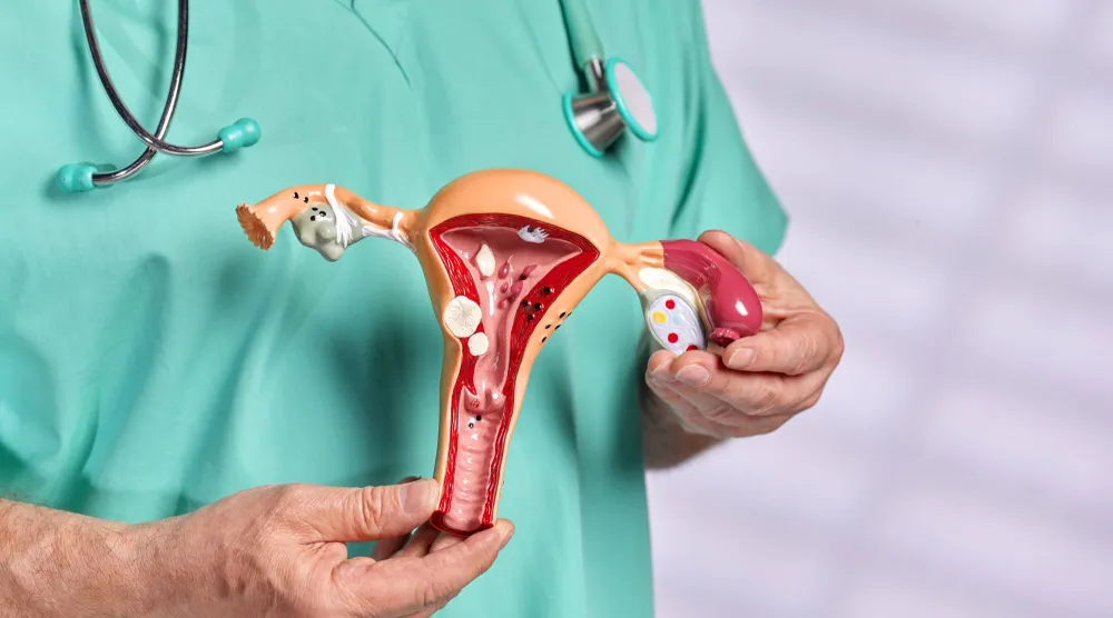 بين جينات الأجداد وكيمياء العصر: لماذا تُصاب بعض النساء بالانتباذ البطاني الرحمي؟