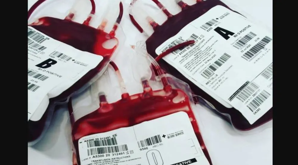 التأكد من فصيلة دمك ممكن عبر فحص تجريه لدى الطبيب أو أثناء التبرع بالدم (بيكسلز)