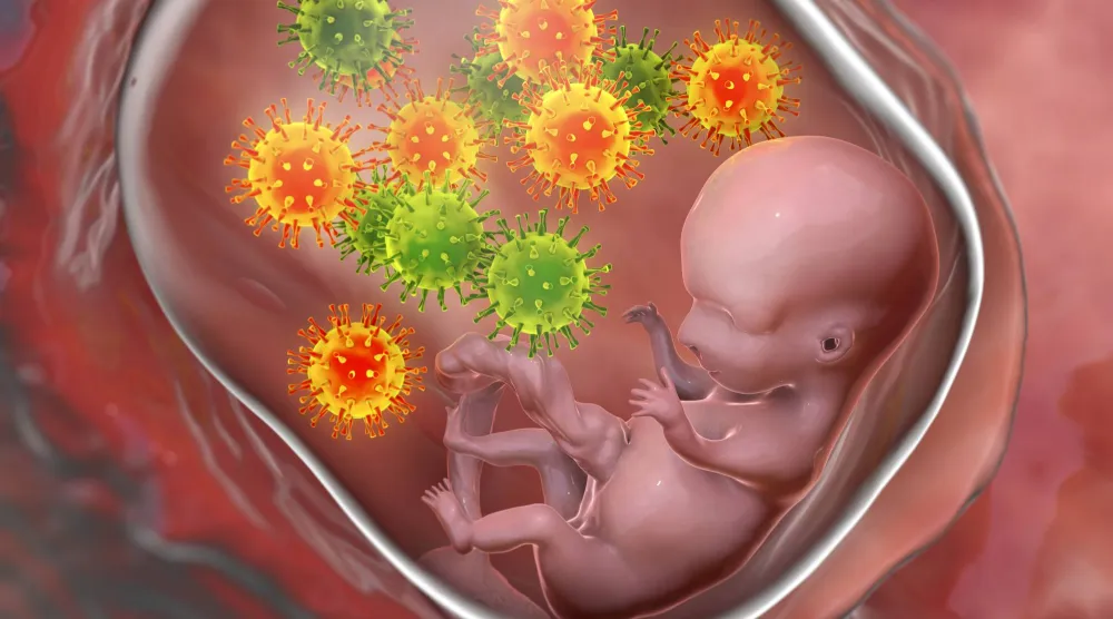 شكل تصويري لانتقال الفيروس المضخم للخلايا عبر المشيمة