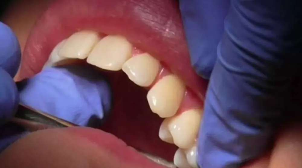 حالة الأسنان قد تتنبأ باحتمالية الوفاة المبكرة (رويترز)