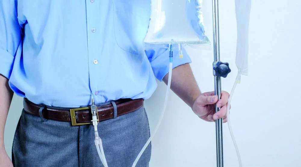 «غسيل الكلى البريتوني»... الأفضل في حفظ القدرات الإدراكية