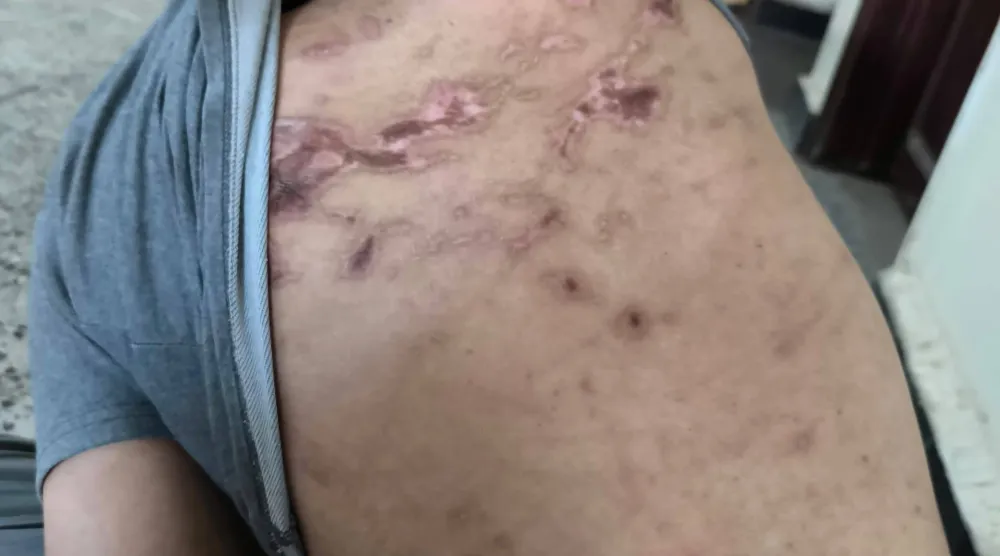 سجن الريان عبارة عن مجموعة من الكونتينرات الموضوعة على مدرج المطار غير معزولة (الشرق الأوسط)