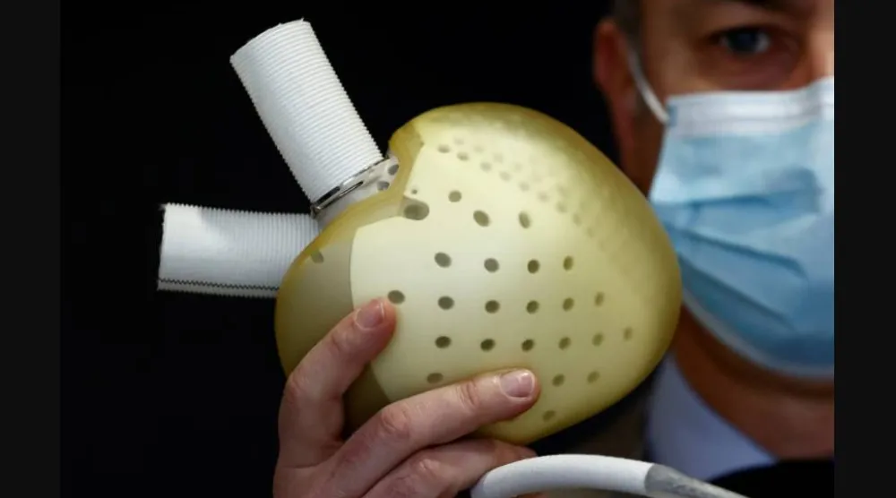 ترتبط صحة القلب ارتباطاً وثيقاً بنمط الحياة والنظام الغذائي اليومي (رويترز)