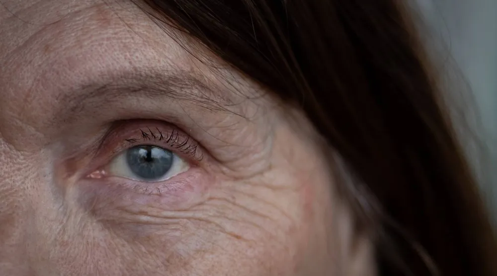 مرض التنكّس البقعي يؤدي تدريجياً إلى تراجع الرؤية المركزية (جامعة آلتو)