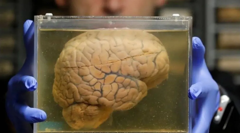 بعض السلوكيات قد تكون علامة على عقل نشط (رويترز)