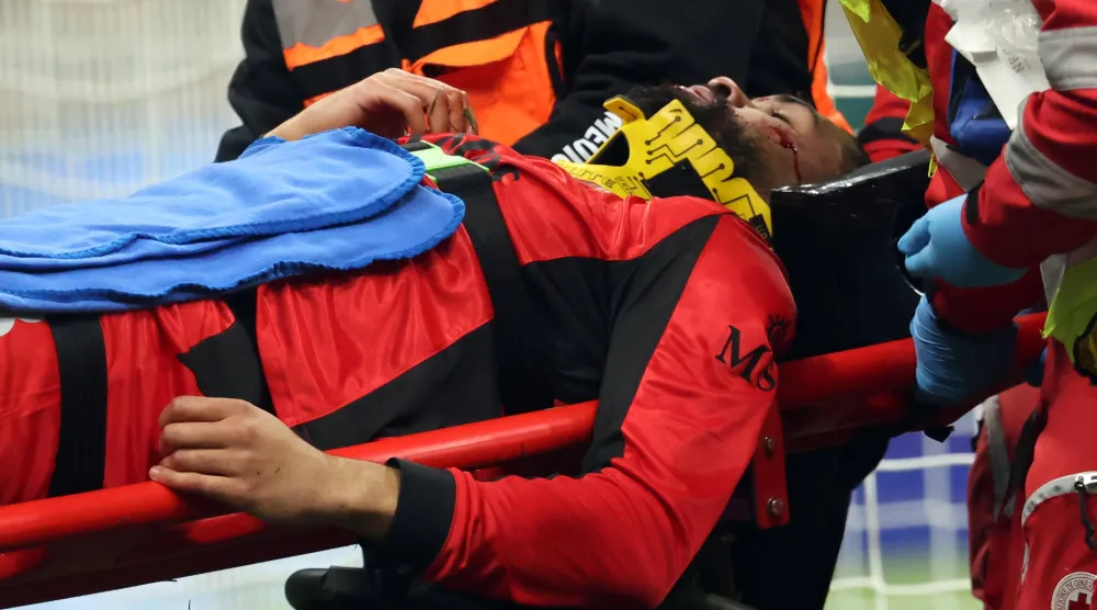 روبن لوفتوس-تشيك أصيب بكسر في الفك (إ.ب.أ)