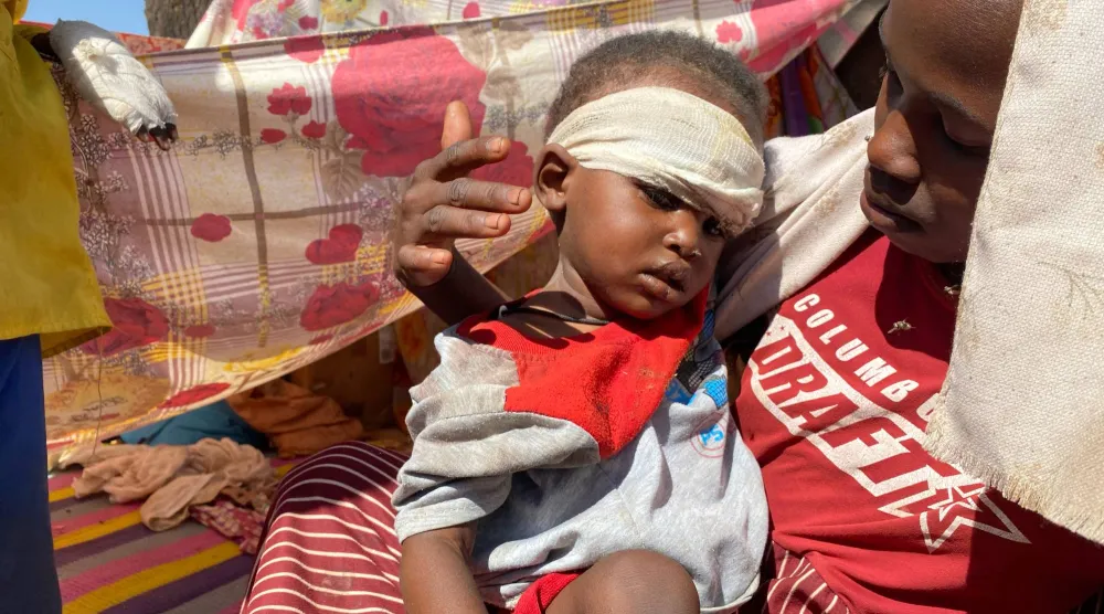 طفل سوداني فرّ من مدينة الفاشر مع عائلته يتلقى العلاج في مخيم بمدينة الطويلة (أرشيفية - أ.ب)