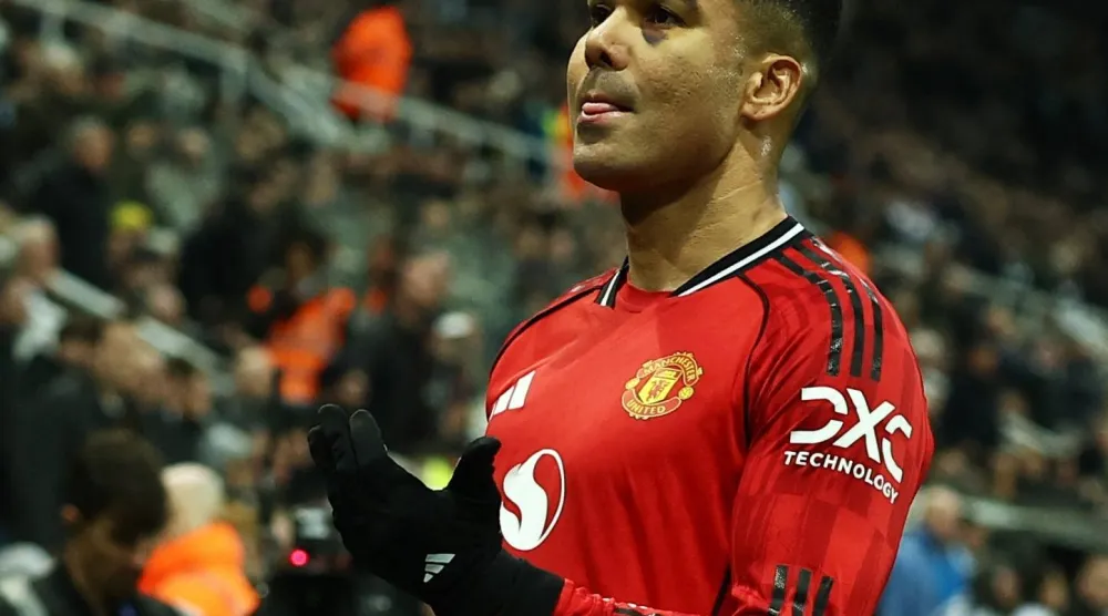 كاسيميرو وتبدو آثار الندبة تحت عينه (رويترز)