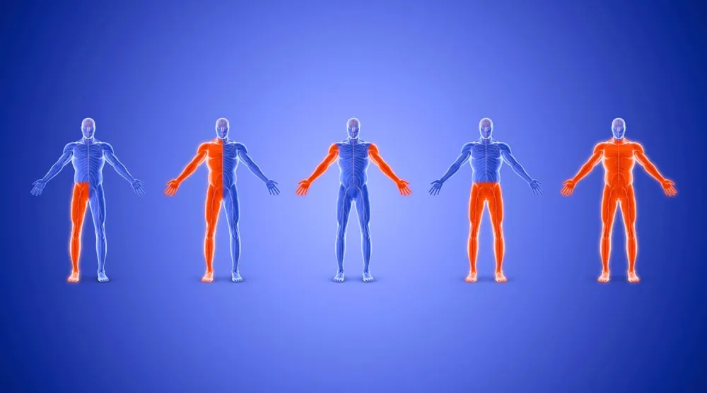 مرونة مفرطة في المفاصل وهشاشة الأنسجة… من أعراض متلازمة إهلرز - دانلوس مفرطة الحركة