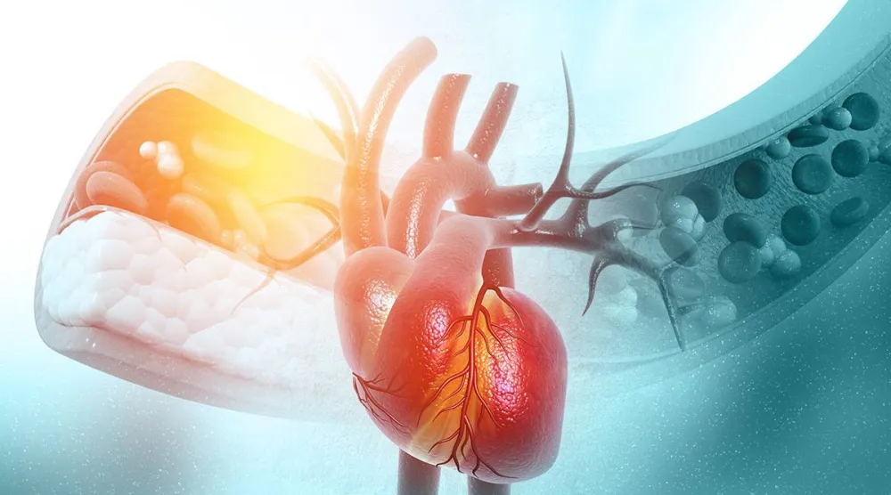 ارتفاع مستويات الكولسترول الضار في الدم تزيد خطر الإصابة بأمراض القلب (جامعة كونيتيكت)