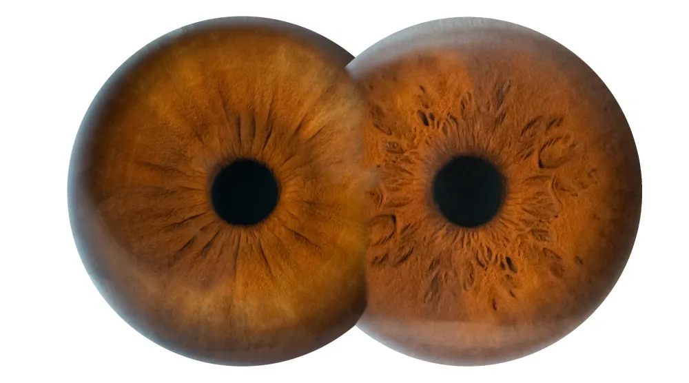 رؤى علمية رائدة لعلاج العمى الوراثي