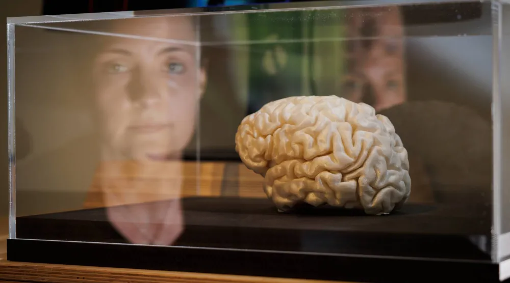 هناك بعض العادات الأساسية التي يجب عليك تضمينها في روتينك اليومي لدعم صحة الدماغ (د.ب.أ)